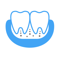 Спортивные каппы - Стоматологическая клиника "Стоматология МС", Екатеринбург